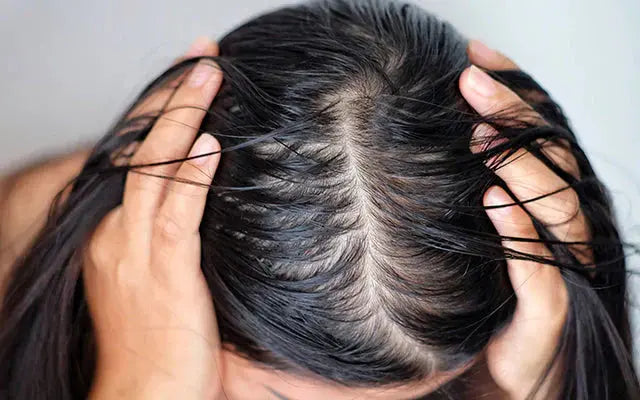 Shampoing-cheveux-gras SAVEO