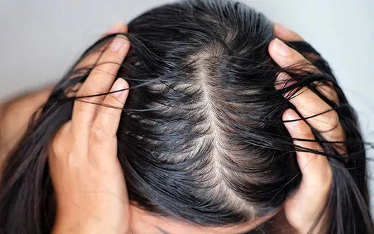 Shampoing-cheveux-gras SAVEO